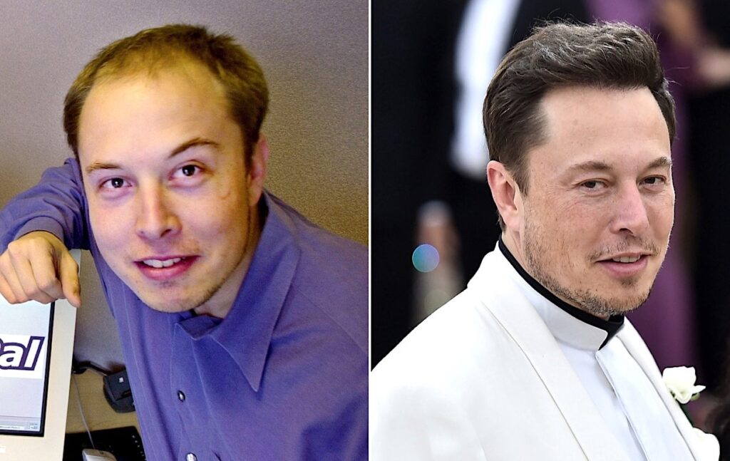 https://www.aram-clinic.com/blog/wp-content/uploads/2021/06/greffe-cheveux-elon-musk-1024x647.jpg