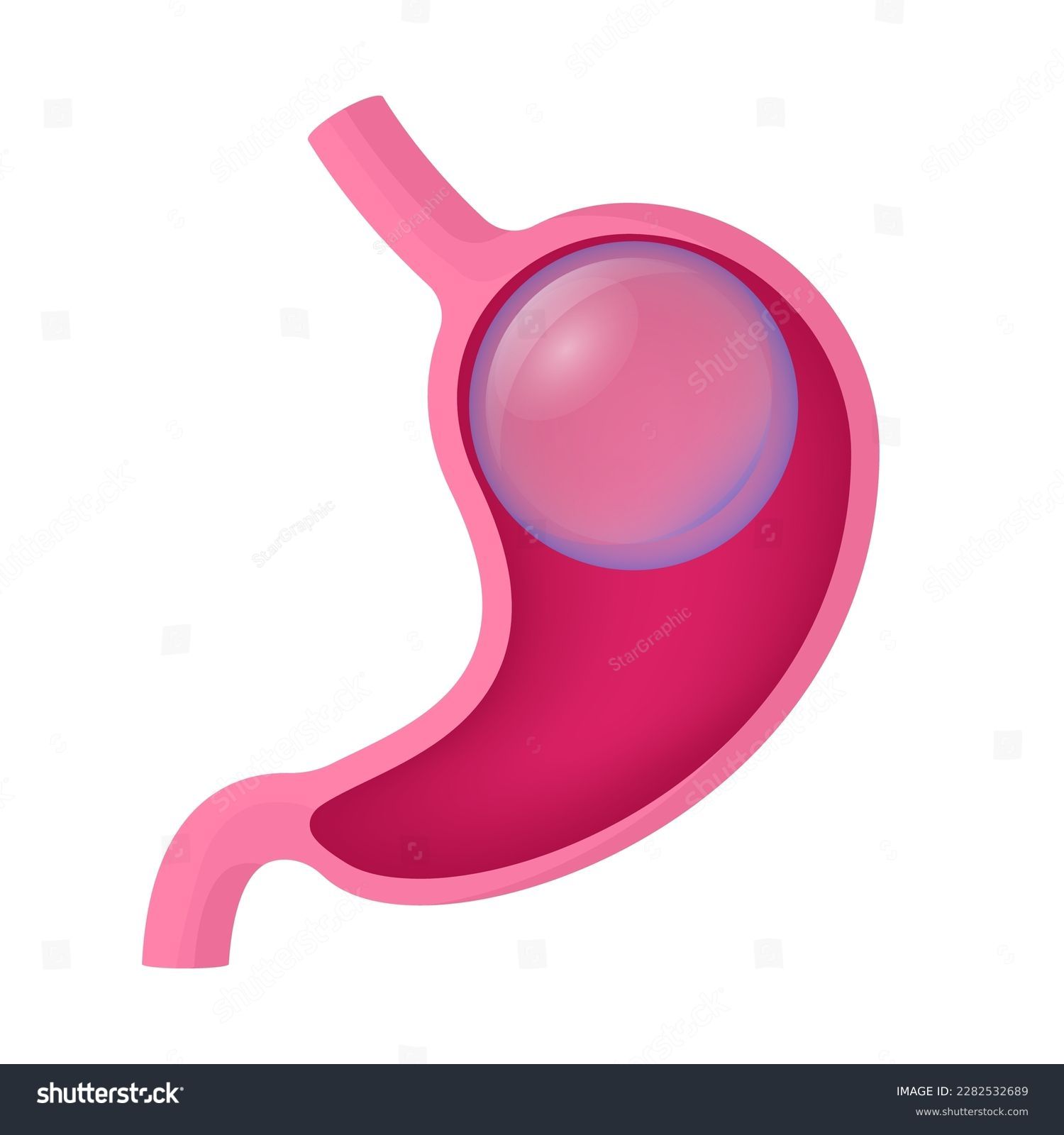 Comprehensive Guide to Gastric Balloon Procedure Prices in Turkey