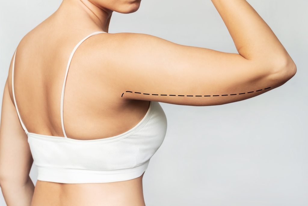 Comprehensive Guide to Arm Liposuction Prices in Turkey: Costs, Factors, and Considerations