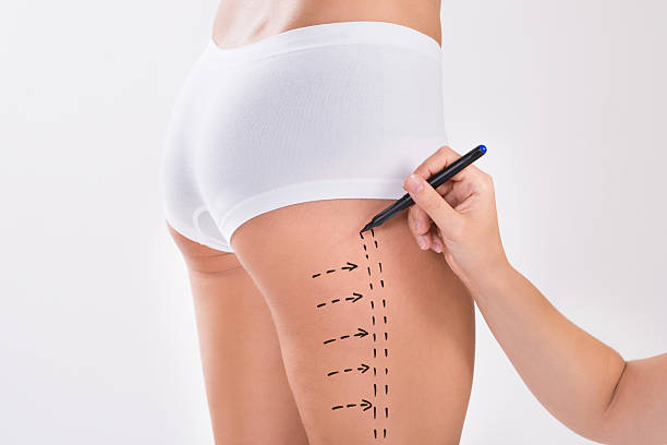 Comprehensive Guide to the Cost of Cosmetic Surgery for Firm Thighs in Turkey