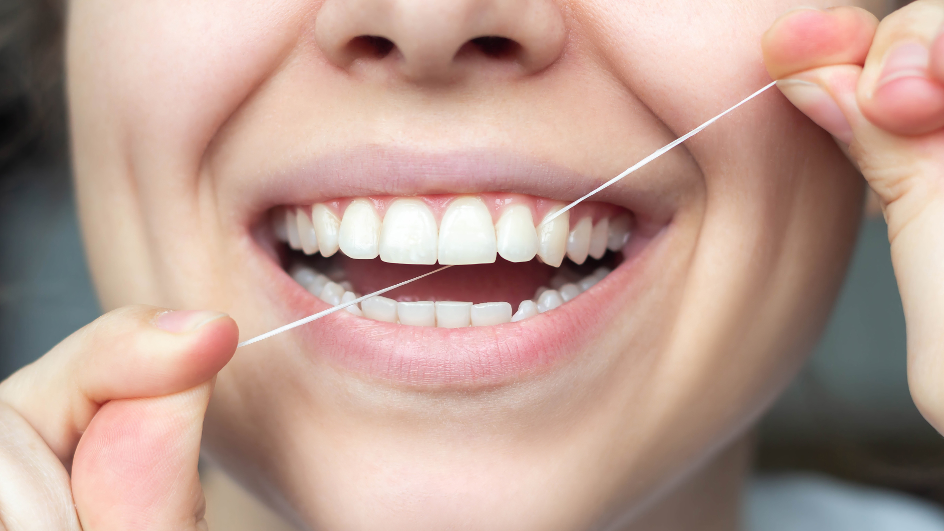 Quels types de soins dentaires sont les plus courants pour refaire ses dents en Turquie ?